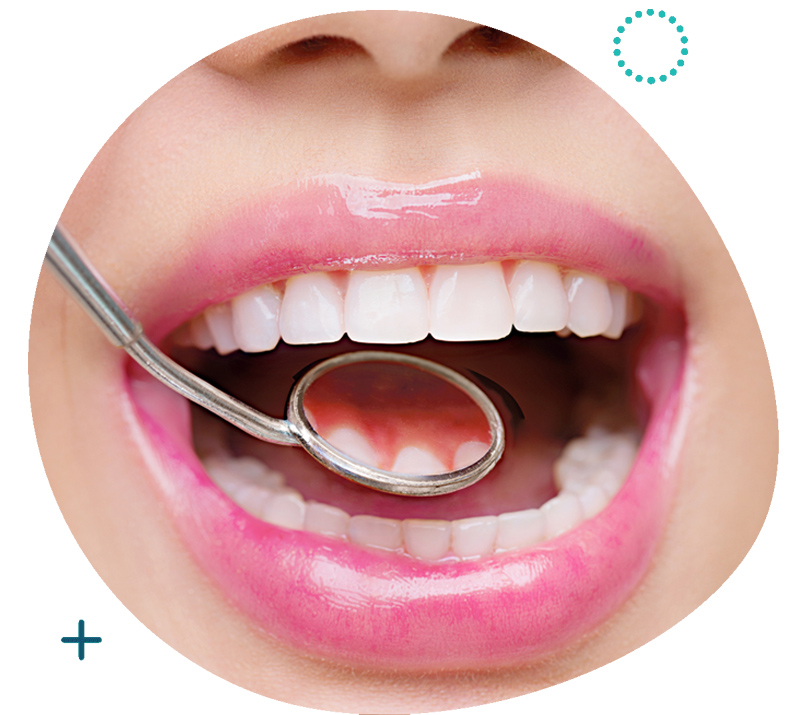 Orthodontic Treatment Singapore